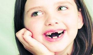 蛀牙怎么补牙齿的视频,牙齿补牙全过程揭秘