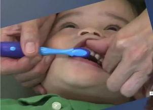 儿童龋齿视频,从视频看口腔健康的重要性